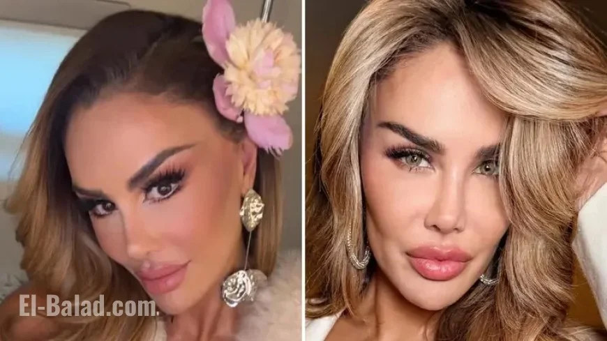 Ninel Conde Unveils New Eye Color After Surgery: See Her New Look