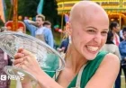Bake Off Winner Reveals Alopecia Transformed Her Beauty Perception