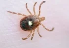 First Alpha-Gal Syndrome Death in N.J. Linked to Tick-Borne Meat Allergy