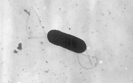 Snohomish County Resident Leads State’s Listeria Outbreak Cases