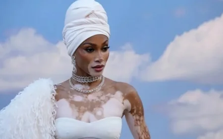 Winnie Harlow Addresses Backlash Over Whitney Houston Halloween Costume