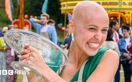 Bake Off Winner Reveals Alopecia Transformed Her Beauty Perception