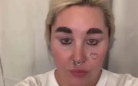 Amanda Bynes Uses Weight-Loss Drug for Slimmer, Attractive Look