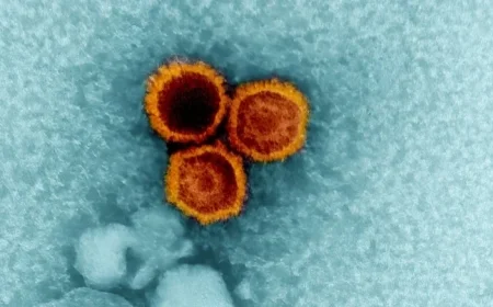 Study Links Common Epstein-Barr Virus to Lupus Development