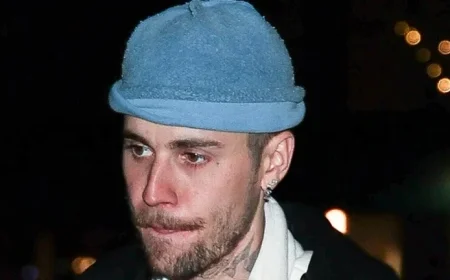 Justin Bieber Injures Ribs in Electric Skateboard Mishap