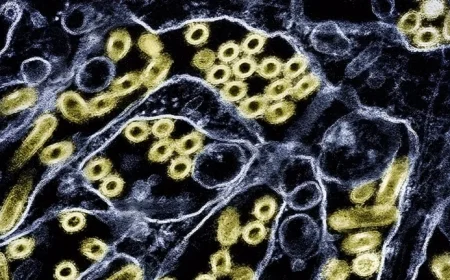 First US Human Bird Flu Case in 9 Months Involves Animal-Only Strain