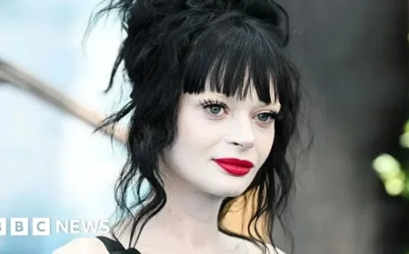 Ruth Codd of ‘Celebrity Traitors’ Recovering After Second Leg Amputation