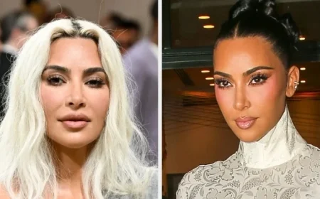 Kim Kardashian Reveals Brain Holes in Health Update