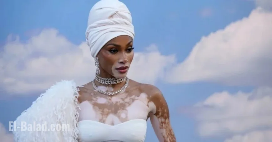 Winnie Harlow Addresses Backlash Over Whitney Houston Halloween Costume