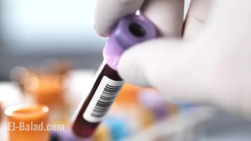 CRISPR Gene-Editing Reduces High Cholesterol, New Study Finds