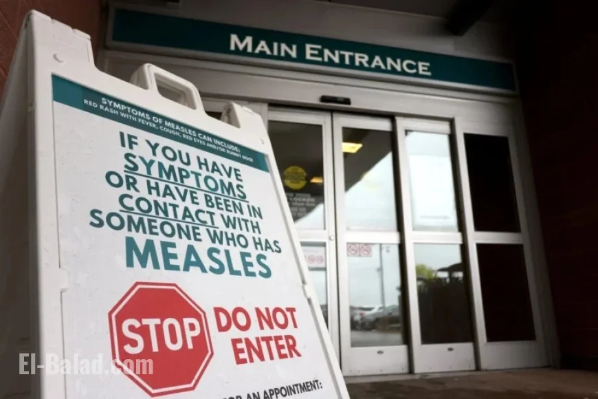 Canada Loses Measles Elimination Status After 25 Years