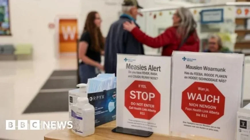 Canada Loses Measles-Free Status; US Risks Following Suit