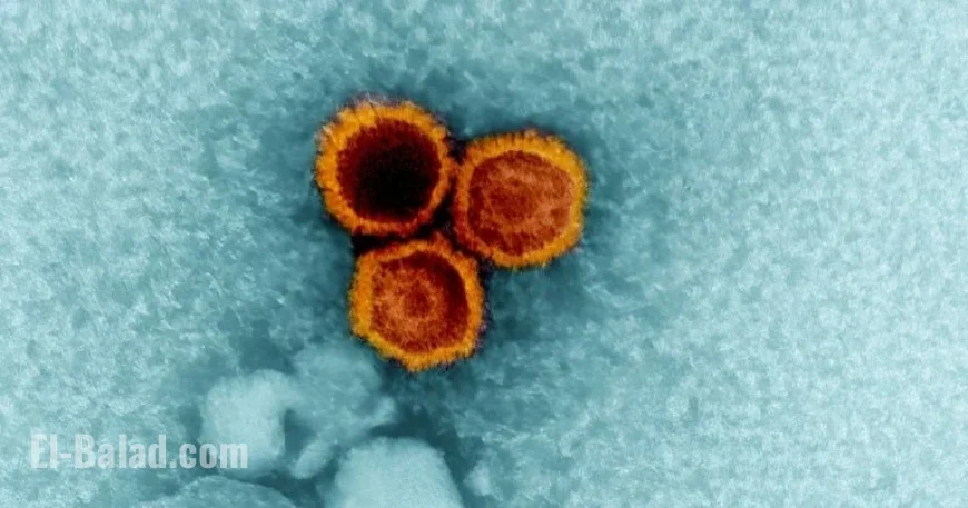 Study Links Common Epstein-Barr Virus to Lupus Development