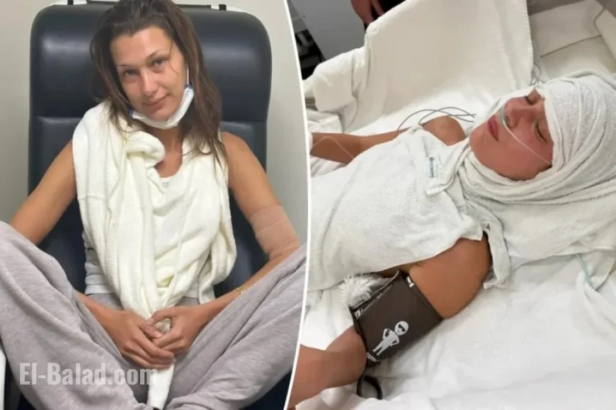 Bella Hadid Opens Up About ‘Medical Anxiety’ in Chronic Lyme Disease Struggle