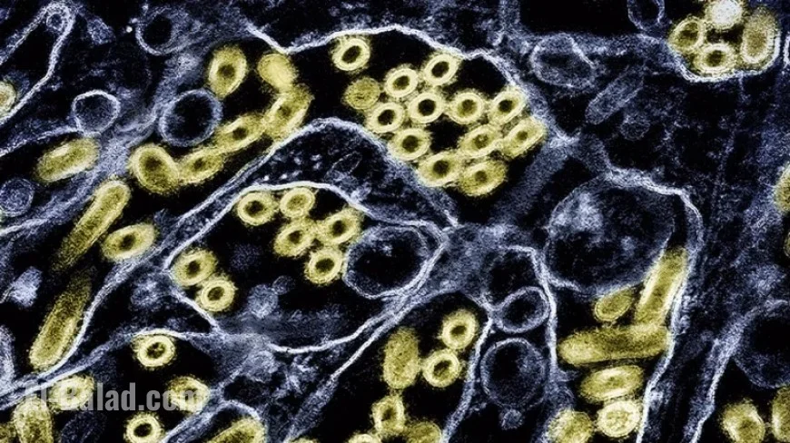 First US Human Bird Flu Case in 9 Months Involves Animal-Only Strain