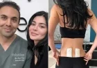 Kylie Jenner Undergoes Stem Cell Therapy for Chronic Post-Pregnancy Back Pain Relief