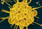 FDA Approves New Antibiotics for Gonorrhea, Targeting Drug Resistance