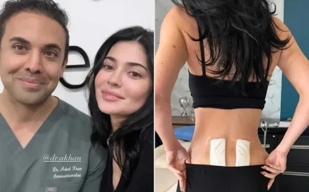 Kylie Jenner Undergoes Stem Cell Therapy for Chronic Post-Pregnancy Back Pain Relief