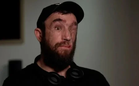 Trump Pressures Ukraine to Cede Land; Wounded Soldier Questions Sacrifice