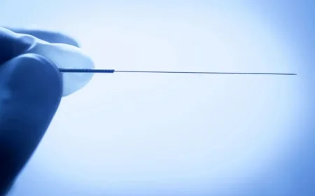 Understanding Dry Needling: Risks Highlighted After T.J. Watt’s Lung Collapse