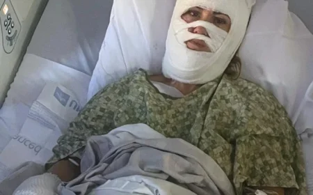 Woman Severely Burned in Georgia Park Chemical Attack