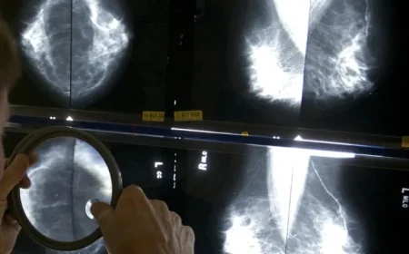 AI Companies Assert Mammograms Detect Various Health Risks