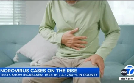 Health Department Reports Surge in Norovirus Cases in Los Angeles County