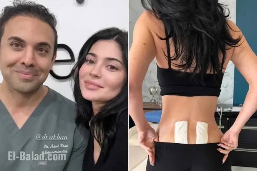 Kylie Jenner Undergoes Stem Cell Therapy for Chronic Post-Pregnancy Back Pain Relief