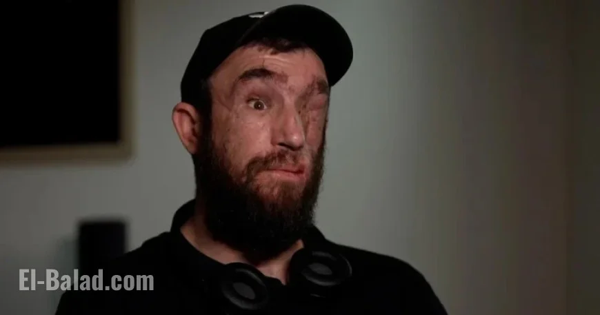 Trump Pressures Ukraine to Cede Land; Wounded Soldier Questions Sacrifice