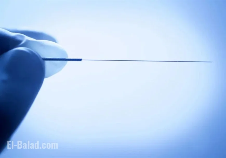 Understanding Dry Needling: Risks Highlighted After T.J. Watt’s Lung Collapse