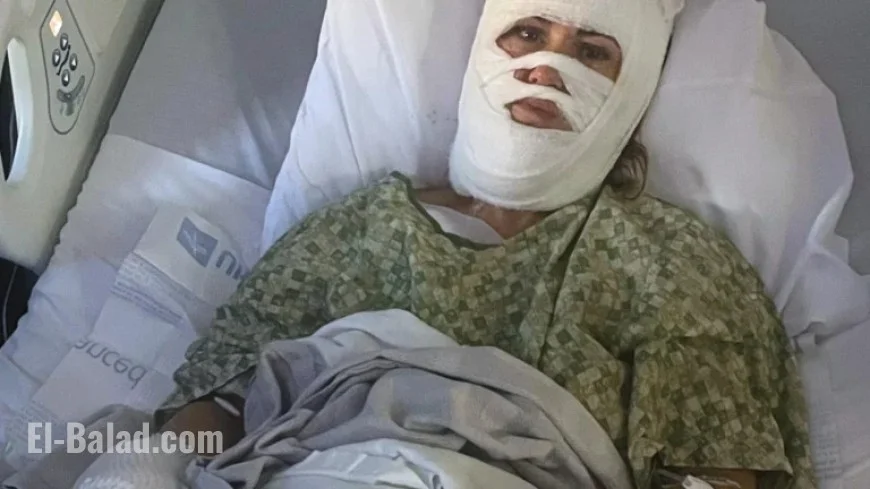 Woman Severely Burned in Georgia Park Chemical Attack