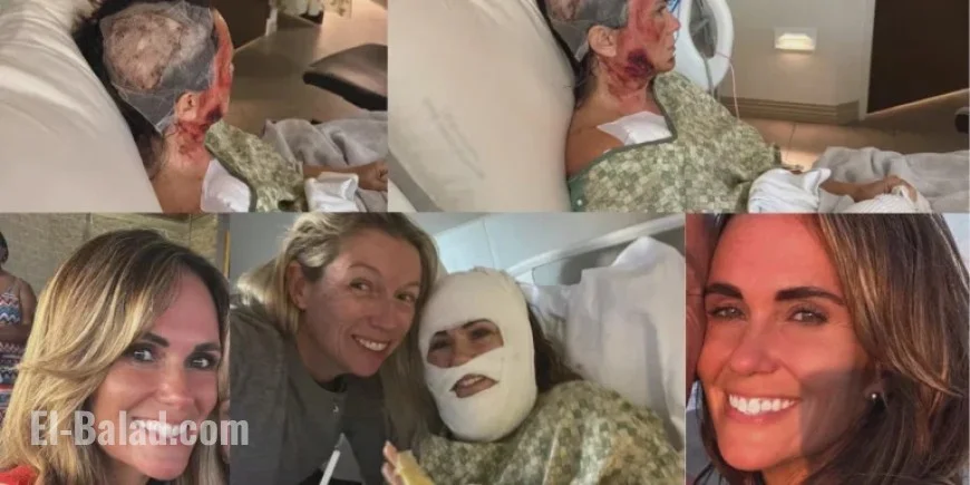 Forsyth Park Acid Attack: Woman Badly Burned, Community Expresses Concern