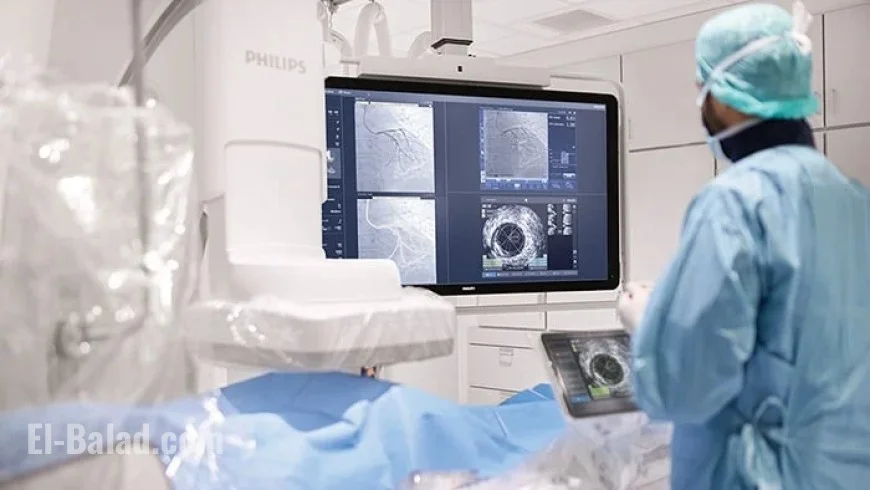 Philips Acquires SpectraWAVE Inc.: Strategic Expansion in Healthcare Technology