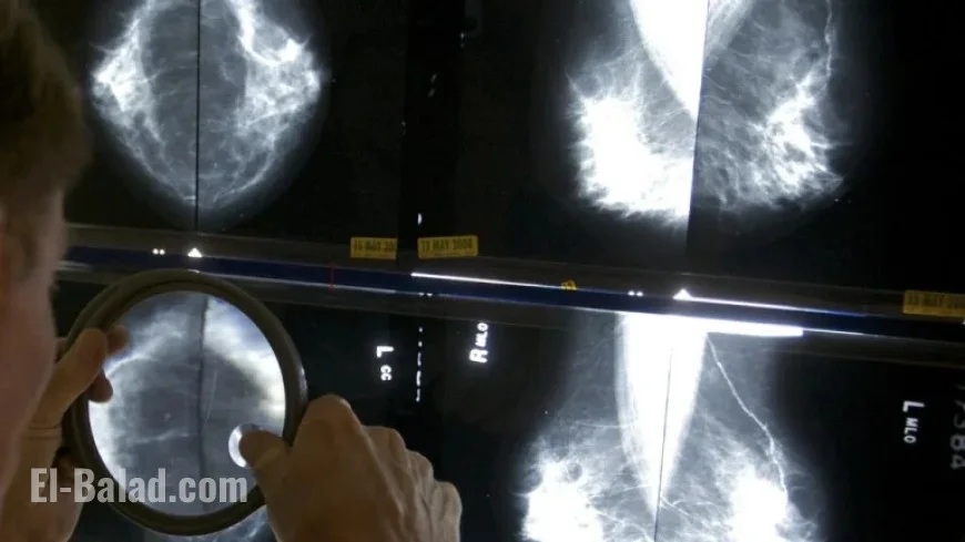AI Companies Assert Mammograms Detect Various Health Risks