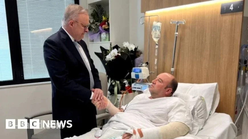 Australia PM Albanese Visits Hero Ahmed al Ahmed in Bondi Hospital
