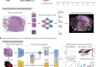 AI-Driven Spatial Proteomics Unveils Lung Cancer Biomarkers from Histopathology