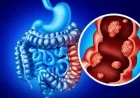 Targeted Immunotherapy Enhances Outcomes in Advanced Metastatic Colorectal Cancer