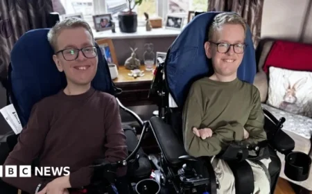 Jesy Nelson’s Twins Support Each Other Through Spinal Muscular Atrophy