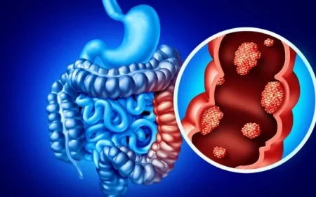 Targeted Immunotherapy Enhances Outcomes in Advanced Metastatic Colorectal Cancer