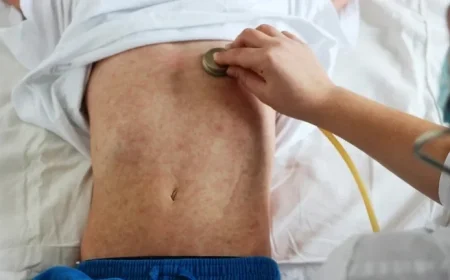 Northern Mindanao Measles Cases Surge 11%, 74% Remain Unvaccinated