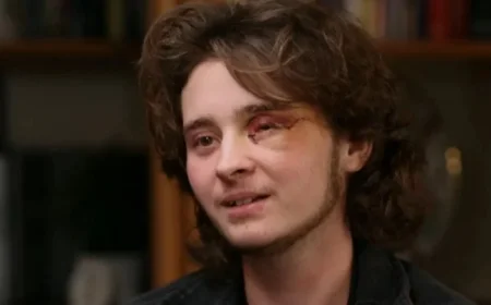 21-Year-Old Suffers Left Eye Blindness After Agent’s Less-Lethal Round at Protest