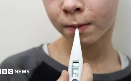 UK Loses Measles Elimination Status: A Public Health Setback