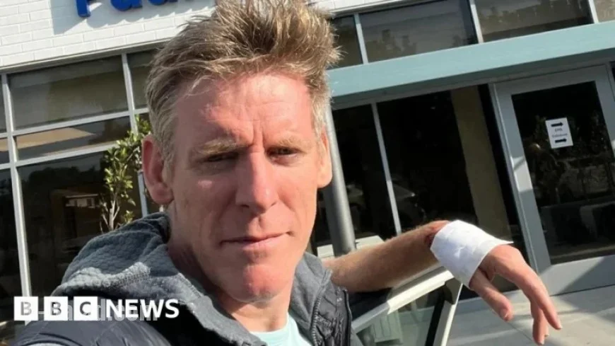 Shark Attack Survivor Triumphs in Swimming Challenge