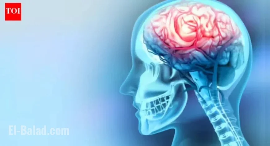 Understanding Aneurysms: Causes of Sudden Brain Vessel Weakening