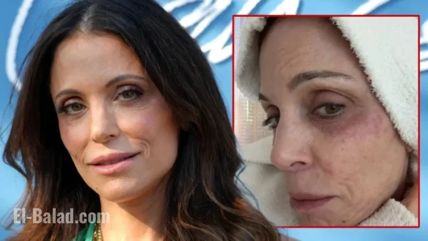 Bethenny Frankel Suffers Bacterial Infection After St. Barths Partying
