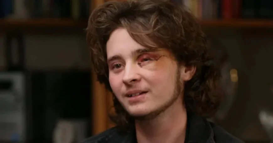 21-Year-Old Suffers Left Eye Blindness After Agent’s Less-Lethal Round at Protest