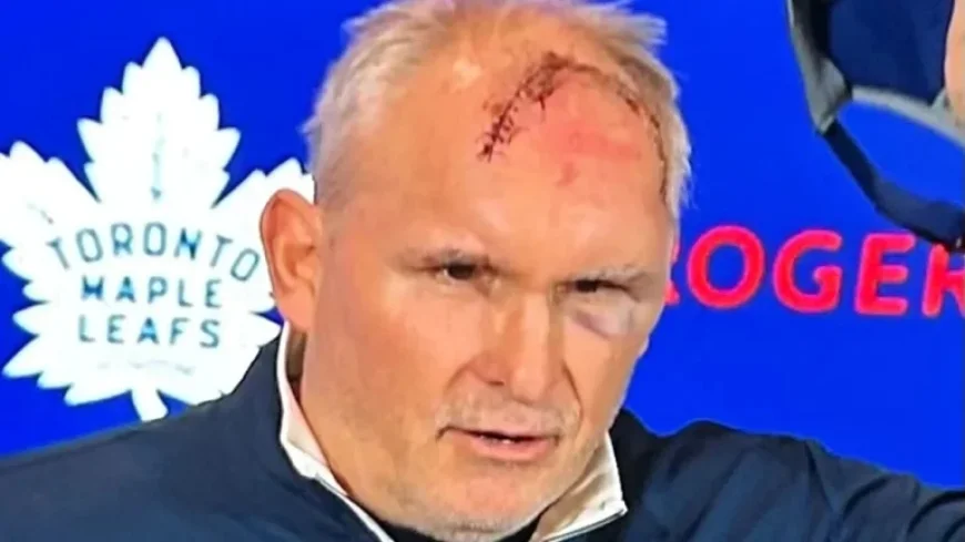 Berube Reveals Forehead Stitches After Gym Accident