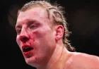 Paddy Pimblett Analyzes Gaethje Loss: ‘He Altered My Appearance’