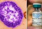 Measles Exposure Alert: Several Wake County Sites Affected