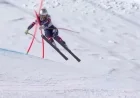 Understanding Complex Tibia Fractures: Lindsey Vonn’s Injury Explained